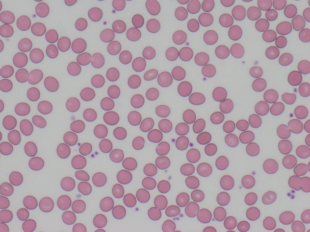 正常な赤血球（均一）の画像